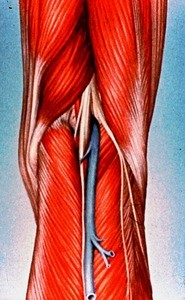 Illustration of popliteal fossa of right knee from posterior, showing muscular boundaries: semi-membranosus, biceps femoris, medial and lateral gastrocnemius muscles; contents: bifurcation vein, as well as sciatic nerve to form tibial and common fibular (peroneal) nerves, popliteal artery and small saphenous vein