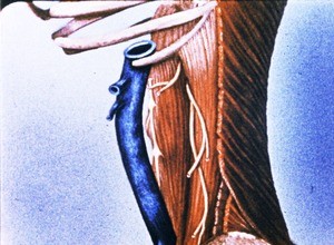 Illustration of "back" of thoraco-abdominal region, showing latissimus dorsi muscle, quadratus lumborum and psoas major muscles, inferior vena cava, subcostal and lumbar spinal nerves