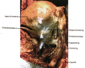 Natural color photograph of dissection of the right glenohumeral joint, anterior view with image rotated 90 degrees clockwise, showing the glenohumeral capsule, bones, muscles, and ligaments