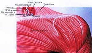 Illiustration of the left pectoral and lower neck region, anterior view, showing muscles, arteries, and veins