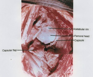 Natural color photograph of dissection of right hip, anterior view, showing the acetabular rim, femoral head, and fibrous capsule