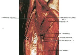 Natural color photograph of dissection of the right thigh, anterior view, showing femoral vasculature