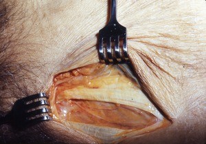 Natural color photograph of superficial dissection of the inguinal region, anterior view