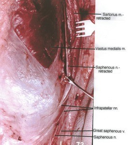 Natural color photgraph of right knee, anteromedial view, showing vein, muscles and nerves with the Sartorius muscle retracted