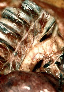 Natural color photograph of dissection of the right pleural space, anterior view, with the lung removed to expose the major nerves and vessels