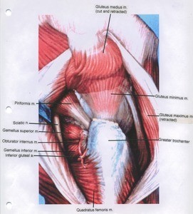 Illustration of dissection of the right gluteal region, posterior view, with the gluteus maximus muscle cut and retracted and the gluteus medius muscle cut and reflected superiorly