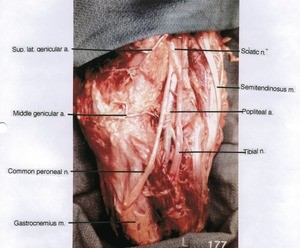 Natural color photograph of left knee, posterior view, showing muscles, nerves and arteries