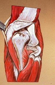 Illustration of posterior surface of right elbow with joint opened to expose the capitulum of the humerus, and the olecranon (each partially sectioned); also, head of radius