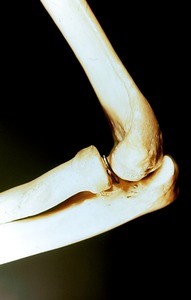 Color photograph of articulated dried bones of flexed left elbow, lateral view of humerus, radius and ulna