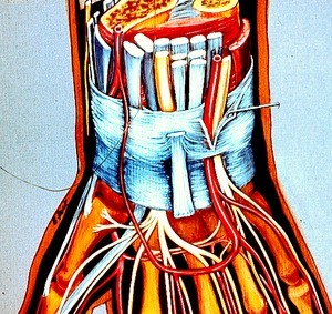 Color illustration of right wrist, anterior view, showing arteries, nerves, bones and extensor retinaculum with the palmar carpal ligament partially retracted