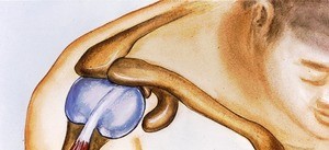 Illustration of dissected right glenohumeral joint, anterior view, showing relations of scapula and clavicle to head of humerus