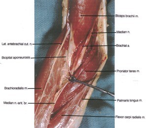 Natural color photograph of dissection of right cubital region, anterior view, showing major nerves and musculature