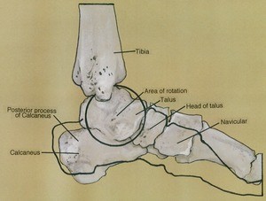 Illustration of bones of the left ankle and foot, medial view