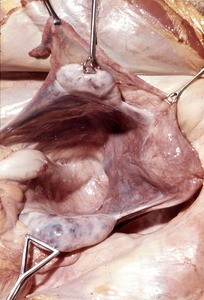 Natural color photograph of dissection of the pelvic cavity, anterior view, with the ovaries and uterus retracted to expose the rectouterine pouch (pouch of Douglas)