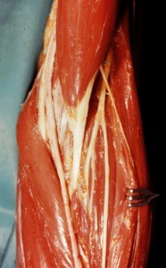 Natural color photograph of dissection of the left cubital fossa, anterior view