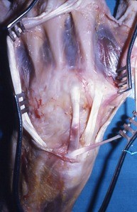 Natural color photograph of dissection of the dorsal surface of the left hand, with the extensor tendons retracted