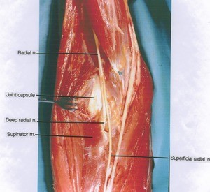 Natural color photograph of right elbow, anterior view, showing muscles and nerves