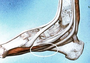 Illustration of the bones of the right ankle, medial view, showing the evertor tendons