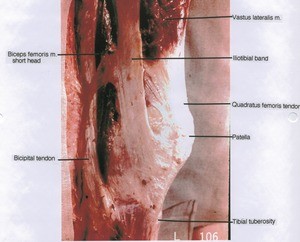 Natural color photograph of right knee, lateral view, showing muscles, tendons and bone