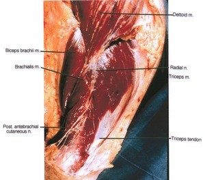 Natural color photograph of left arm, lateral view, showing muscles and nerves