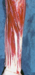 Natural color photograph of dissection of the left forearm, anterior view