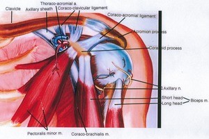 Illustration of dissection of the left shoulder, anterior view, showing the related musculature and vasculature