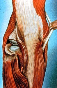 Illustration of posterior view of left elbow, opened to show articulation of radial head with capitulum of humerus; forceps grasping ulnar nerve