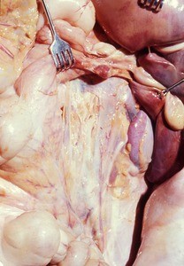 Natural color photograph of dissection of abdomen, anterior view, showing the posterior body wall