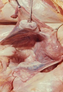 Natural color photograph of dissection of the pelvic cavity, anterior view, with the uterus and left ovary retracted to expose the rectouterine pouch (pouch of Douglas)