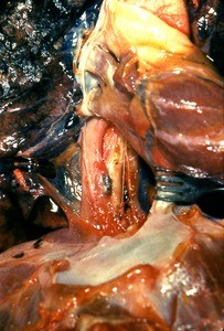 Natural color photograph of dissection of the thoracic cavity, anterior view, with the inferior vena cava retracted to expose the thoracic aorta, esophagus, and esophageal nerve plexus