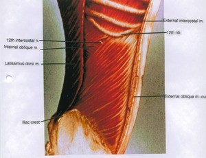 Illustration of dissection of right lower rib cage and flank showing internal abdominal oblique muscle and latissimus dorsi muscle