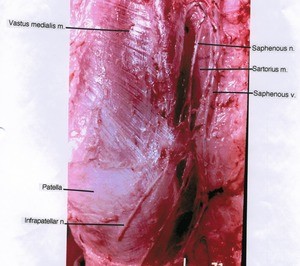 Natural color photograph of lower right thigh and knee, anteromedial view, showing muscles, nerves and vein