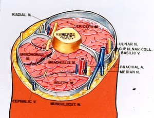 Color illustration of cross section of right arm, superior view, showing muscles, bone, nerves, arteries and veins