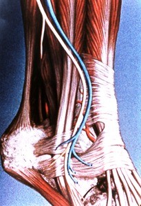 Illustration of dissection of right ankle and heel, lateral view