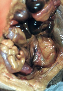 Natural color photograph of dissection of the pelvic cavity, superior view, showing the pelvic viscera and mesentery