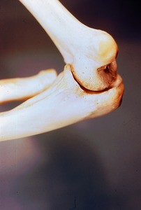 Color photograph of articulated dried bones of rightelbow joint in flexion; medial aspect