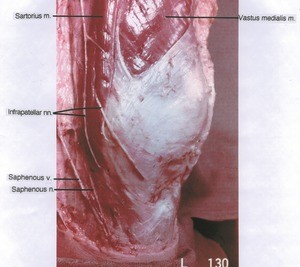 Natural color photograph of left knee, medial view, showing muscles, nerves and vein