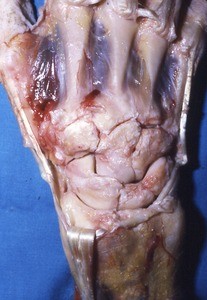 Natural color photograph of dissection of the carpal bones of the right hand, posterior view