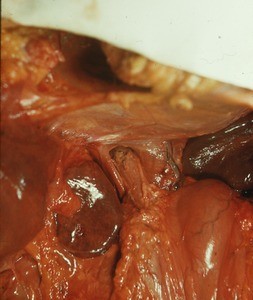 Natural color photograph of dissection of the abdominal cavity, showing the abdominal esophagus entering the stomach