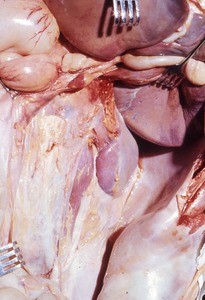 Natural color photograph of dissection of the abdomen, anterior view, showing the posterior body wall