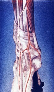 Illustration of dissected semi-pronated right wrist, showing extensor retinaculum, extensor carpi radialis longus muscle & tendon, abductor pollicis longus muscle & tendon, radial artery & dorsal digital branches of the radial nerve