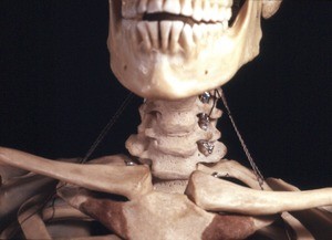 Color photograph of skeletal upper chest and neck, anterior view, showing the bone structure of the upper chest, neck, and mandible