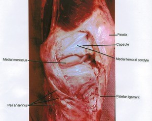Natural color photograph of left knee, medial view, showing pes anserinus, bones, joint cartilage and ligaments