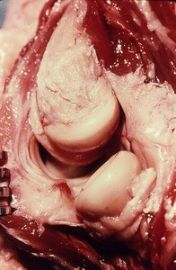 Natural color photograph of dissection of the elbow, lateral view, showing the head of the radius and the lateral epicondyle of the humerus