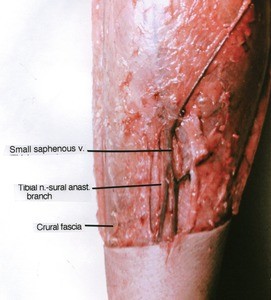 Natural color photograph of right thigh, anterior view, showing fascia, vein and nerves