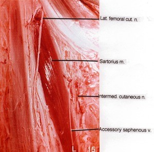 Natural color photograph of right thigh, anterior view, showing muscle, vein and nerves (Lateral femoral cutaneous and intermediate cutaneous nerves)