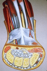 Artist's rendering* of dissected distal left forearm and wrist plus cross section of hand at level of the distal row of carpal bones, and flexor and extensor tendons.*Note: the cross sectional portion of the diagram is more diagramatic than the muscle/tendon portion