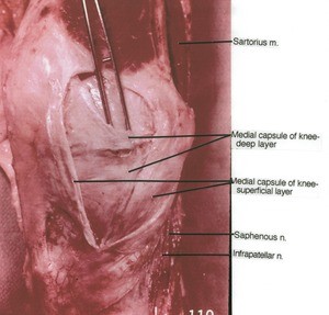 Natural color photograph of right knee, anteromedial view, showing muscle, nerves and medial capsule layers