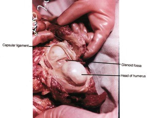 Natural color photograph of dissection of the right glenohumeral joint capsule, anterolateral view, showing the head of the humerus and glenoid fossa