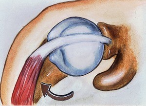 Illustration of dissected right glenohumoral joint, in external rotation (see large arrow), from above, showing tendon of long head of biceps in relation to synovial capsule of humeral head